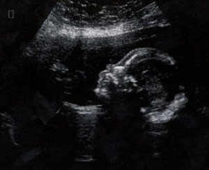 6293_242347425105_665770105_8108694_7445567_n